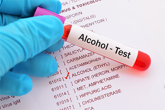 Alcohol Testing Services in Bakersfield