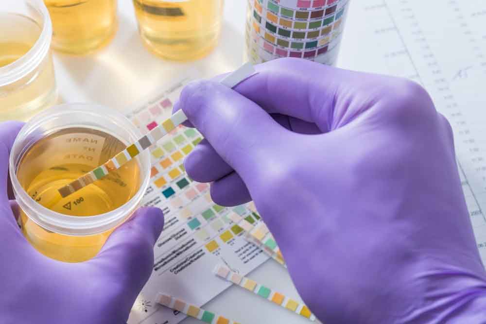 Affordable Urinalysis