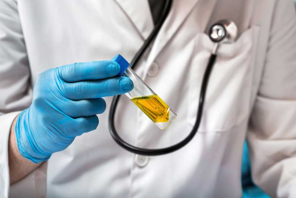 Purpose Of Urinalysis